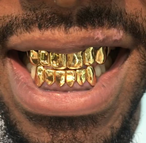 Gold teeth - grillz for Sale in Miami, FL - OfferUp